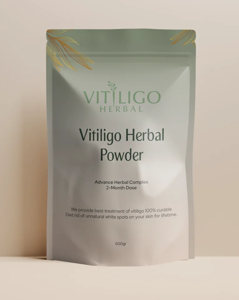 Vitiligo Herbal featured image